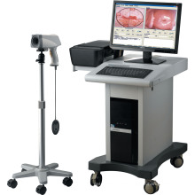 Medical Equipment Gynecological Colposcope Digital Imaging System